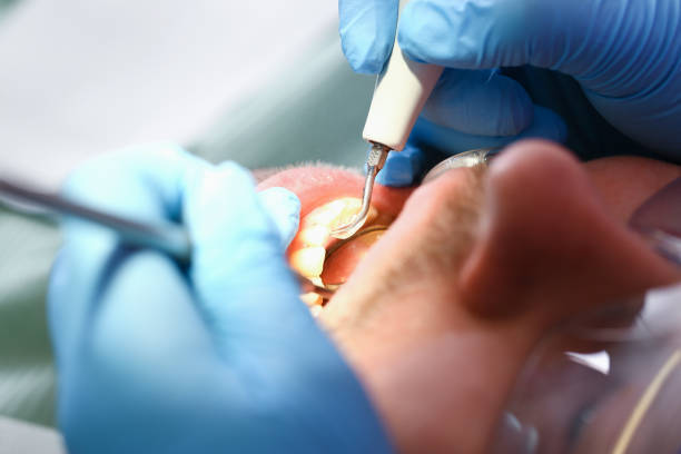 Best Walk-In Emergency Dental Services in Jackson, MO